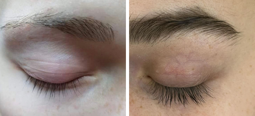 NUVEGA lash eyelash and eyebrow growth serum